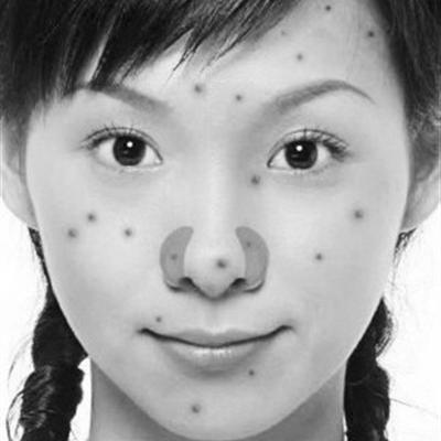 头发里面长痘痘是怎么回事（女生头发里面长痘痘是怎么回事）