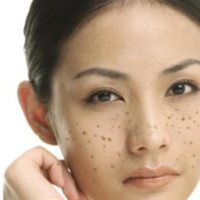 得了湿疹怎么办（湿疹的解决方法）