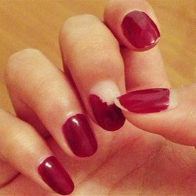 灰指甲的初期症状 灰指甲的初期症状图片