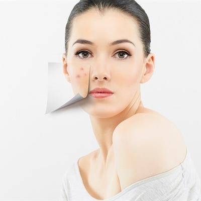 额头上长小米粒疙瘩怎么办（额头长了很多小米粒疙瘩怎么办）