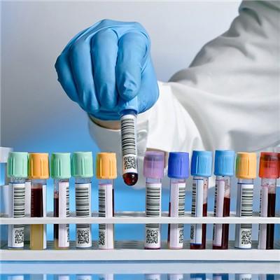 胰腺癌晚期临死症状（胰腺癌晚期临死症状图片）