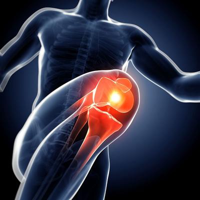 压缩性腰椎骨折是什么 压缩性腰椎骨折是什么伤