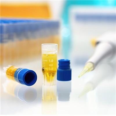 乙肝五项定量对照表怎么看 乙肝5项定量对照表