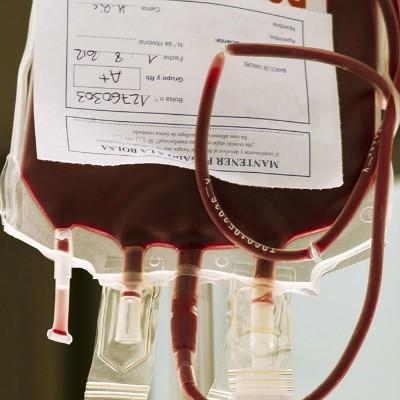 艾滋病晚期症状是什么 艾滋病晚期症状是什么样的