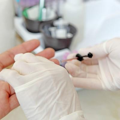 戊肝怎么治疗（得了戊肝怎么治疗）