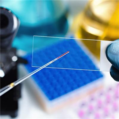 艾滋病窗口期怎么办（艾滋病窗口期如何治疗）