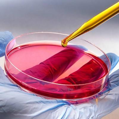 黄疸型肝炎传染吗（病毒性黄疸型肝炎传染吗）