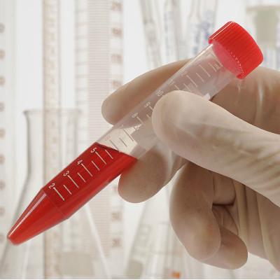 食道癌的治疗方法有哪些（请问一下食道癌有什么好方法治疗）