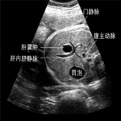 肝囊肿严重吗（肝囊肿严重吗?有什么危害）
