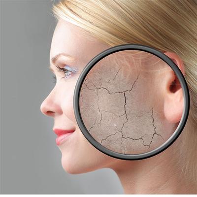 脸上皮肤干燥起皮怎么办（秋天脸上皮肤干燥起皮怎么办）