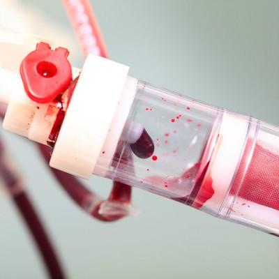 艾滋病患者症状是什么 艾滋病患者症状是什么样的