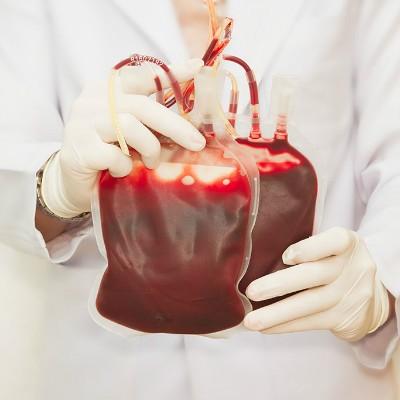 艾滋病发病多久死亡（艾滋病一般多久发病死亡）