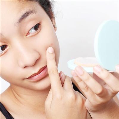 鼻子两侧长痘痘是什么原因（眼睛下面鼻子两侧长痘痘是什么原因）