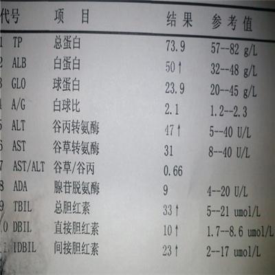 肝功能检查结果的作用是什么（肝功能是检查什么呢）