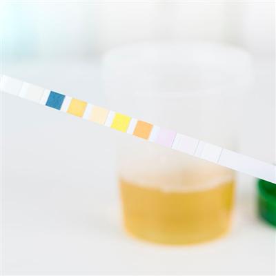 肾功能检查项目包括哪些（肾功能常规检查包括哪些项目）