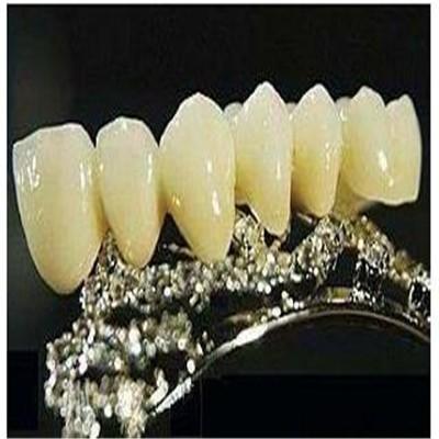 假牙的种类及价格（普通假牙的种类及价格）