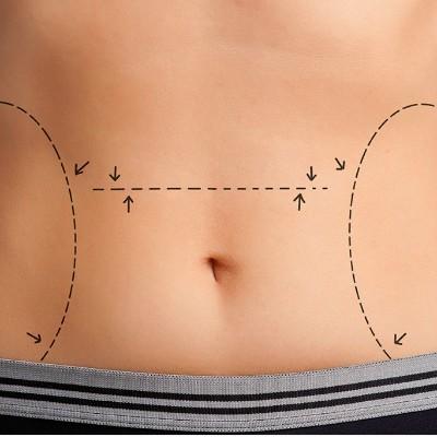 跳绳减肥法多久见效呢 跳绳减肥法几天就见效