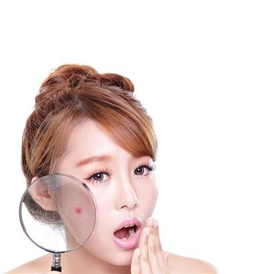 痤疮和粉刺的区别（痤疮和粉刺的区别图片）