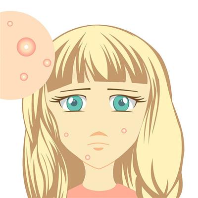 内分泌失调的症状（内分泌失调的症状有哪些）