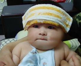 小儿发烧引起的并发症有哪些（小儿发烧引起的并发症有哪些症状）