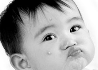 湿疹是什么因素造成的（引起湿疹的因素）