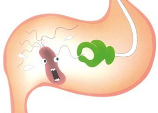 中医治疗慢性胃炎有良方（中医治疗慢性胃炎妙方）