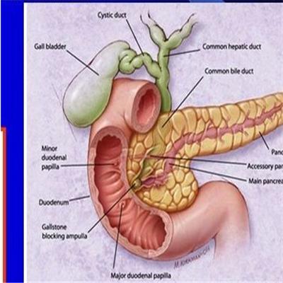 胰腺炎患者能吃蜂蜜吗 胰腺炎患者能吃蜂蜜吗百度百科