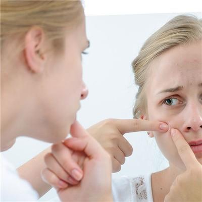 哪种芦荟胶去痘印好 去痘印用哪款芦荟胶比较好