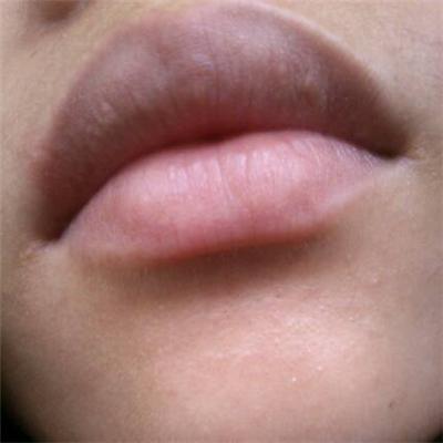 上嘴唇有很多小白点怎么办（上嘴唇有很多小白点怎么办啊）