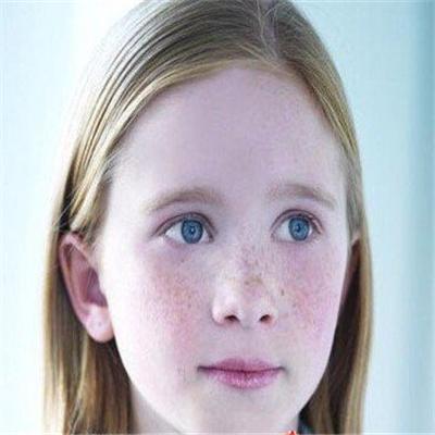 12岁女孩会长斑吗 12岁女孩脸上为什么会长斑