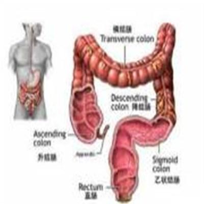 升结肠癌能治愈吗 升结肠癌好治吗