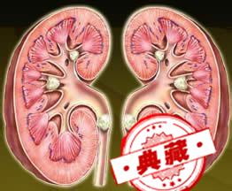 男人如何保护肾脏 男人如何保护肾脏和肾功能