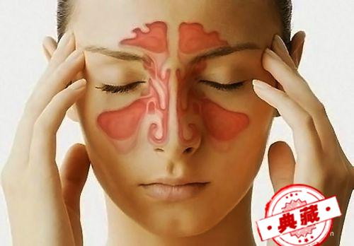 如何正确治疗鼻窦炎 如何正确治疗鼻窦炎的方法