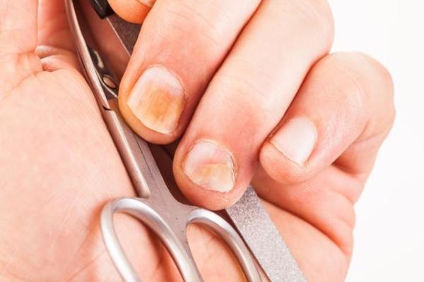 过敏性鼻炎怎么根治?（过敏性鼻炎怎么根治偏方）