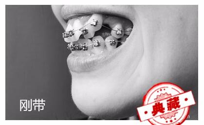 牙齿矫正（牙齿矫正需要多少钱具体多少价格）