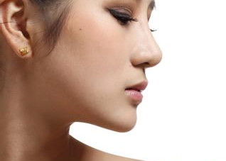 隆鼻手术后为什么不能碰撞鼻子（隆鼻后鼻子不能撞击吗）