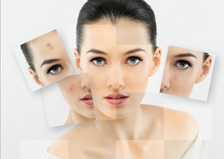 超实用的青春痘疤痕修复小技巧（如何治疗青春痘疤痕）