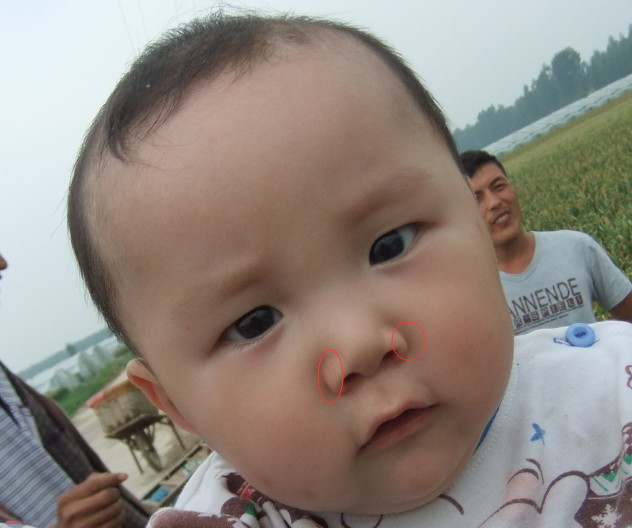 小儿感冒如何护理（小儿感冒如何护理好）