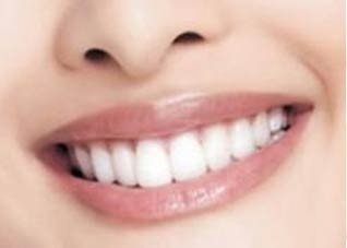 简述美白牙齿的几个方法（简述美白牙齿的几个方法）