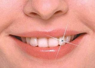 牙齿美白不仅仅靠刷牙（刷牙能美白牙齿吗）