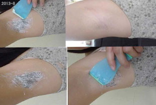 脱毛小偏方 脱毛小偏方经历