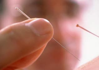 针灸减肥不当易致病 针灸减肥不当易致病的原因