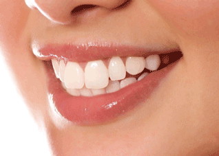 适合牙齿冷光美白有哪些人（冷光美白针对什么样的牙齿）