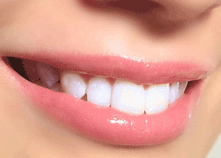 四步助你保持冷光美白牙齿的长效 如何冷光美白牙齿