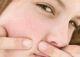 七个必杀技帮你轻松解决痘痘问题 痘痘的最好处理方法