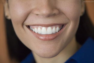 牙齿美白的方法有哪些 牙齿美白什么方法好