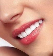 牙齿美白术后有哪些注意事项 牙齿美白术后有哪些注意事项和饮食