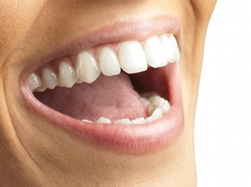 牙齿美白怎么办（牙齿美白有什么办法）