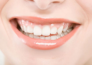 哪些人适合做牙齿冷光美白 哪些人适合做牙齿冷光美白手术