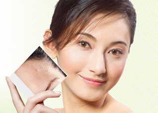 除痘战术的错误做法是什么（杀死痘痘用法对不对）